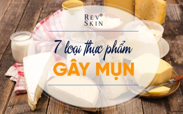 7 loai thuc pham gay mun