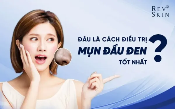 dau la cach tri mun dau den tot nhat 1