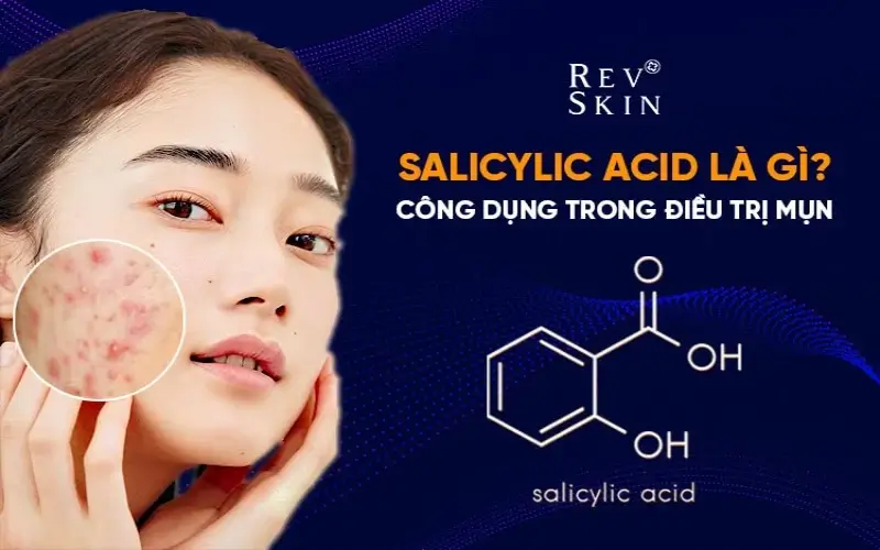 salicylic axit dieu tri mun