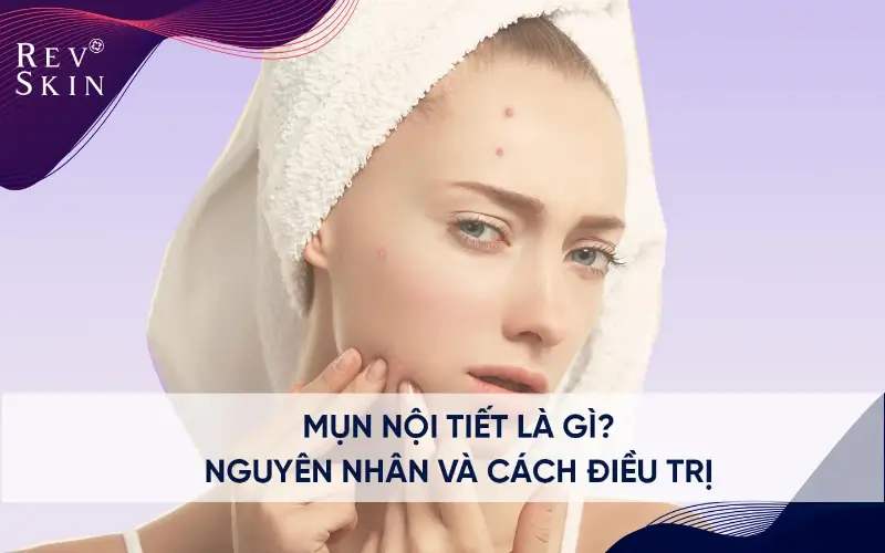 mun noi tiet nguyen nhan va cach dieu tri