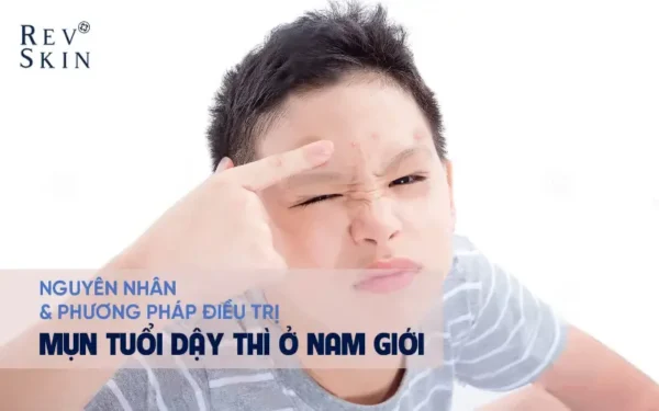 nguyen nhan va cach dieu tri mun day thi