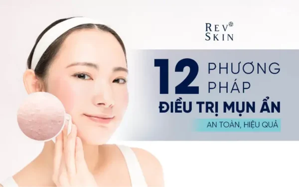 12 cach tri mun an duoi da