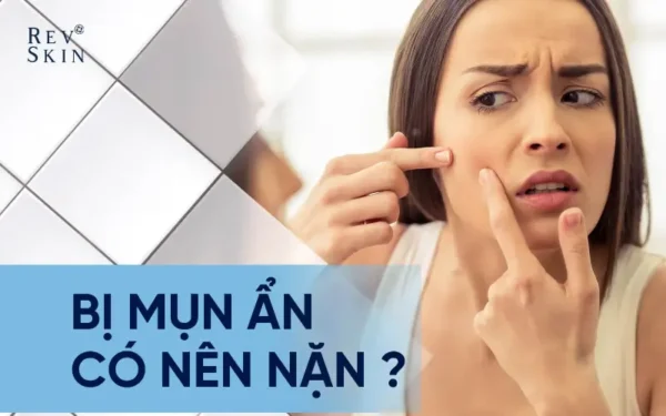 bi mun an co nen nan khong