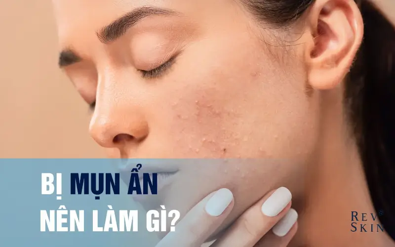 da bi mun an nen lam gi neu muon het mun lau dai