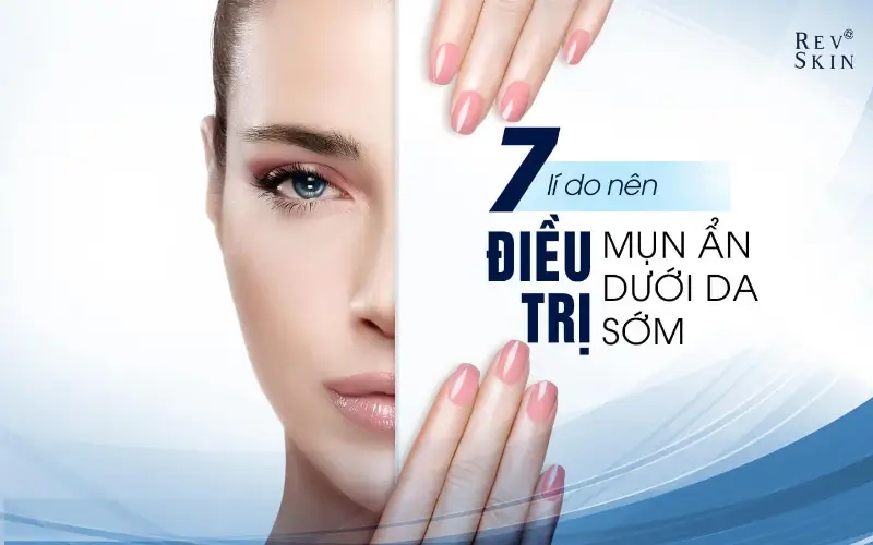 dieu tri mun an duoi da