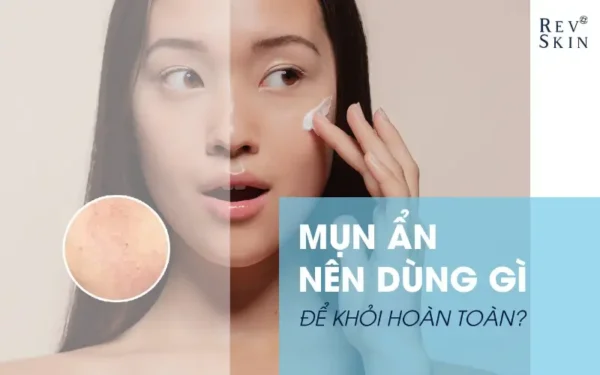 mun an nen dung gi de dat hieu qua ro ret