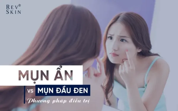 phan biet dieu tri mun an va mun dau den