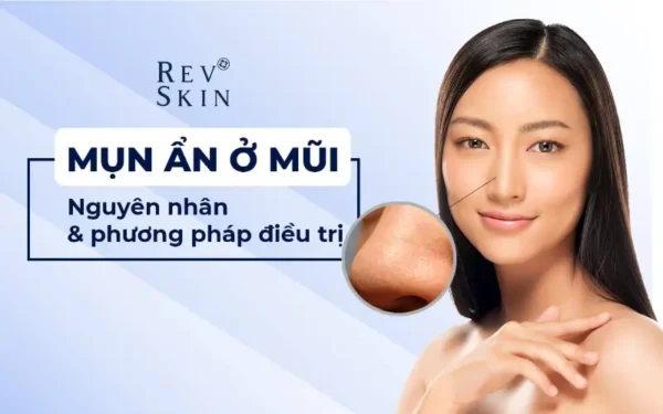 tri mun an o mui cach dieu tri