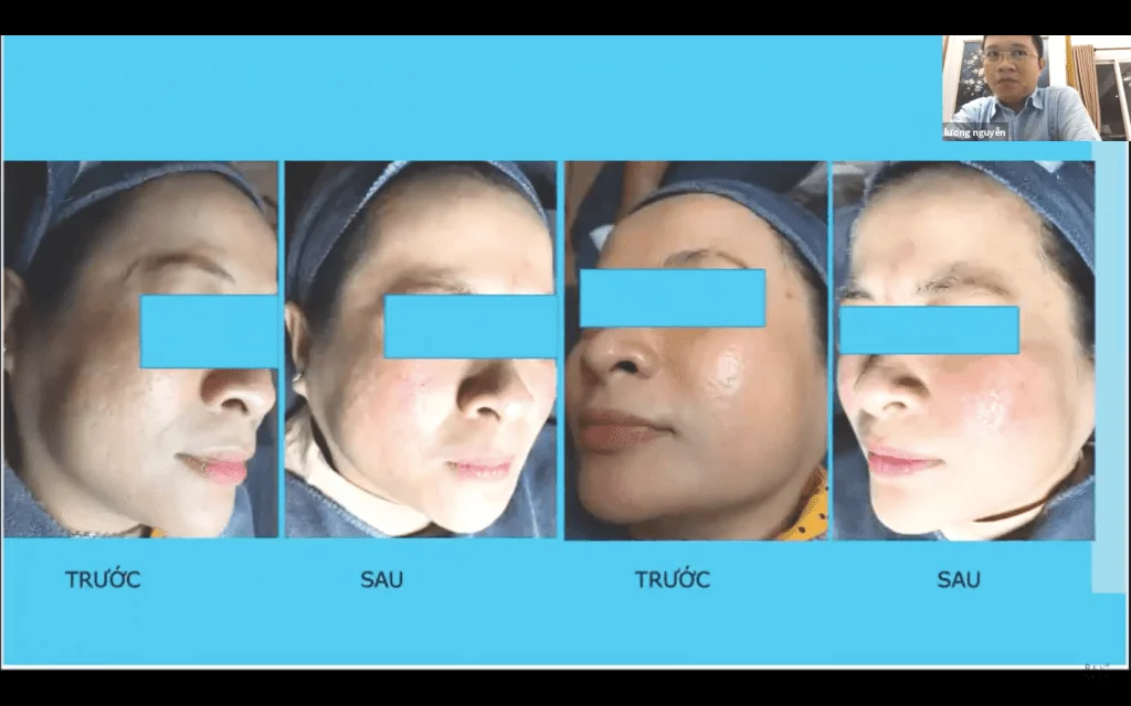 workshop dieu tri seo ro va khung hoang mua dich 2