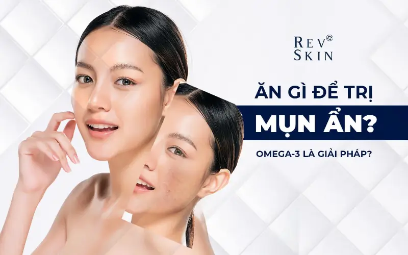 an gi de tri mun an bang omega 3