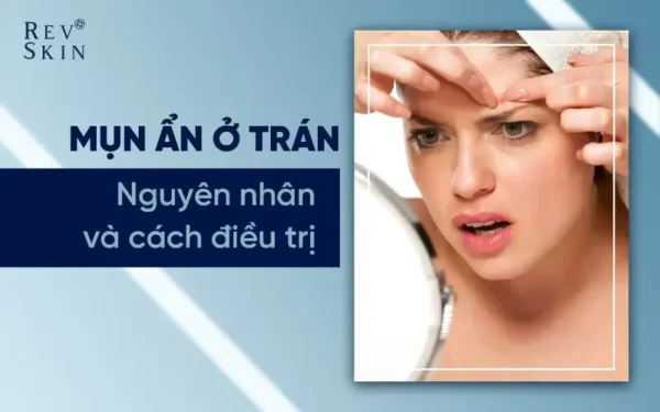 dieu tri mun an o tran