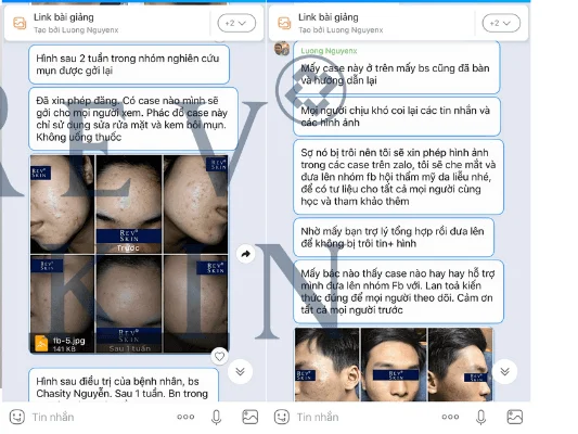 Revskin Acne Cream có thật sự hiệu quả trong trị mụn?