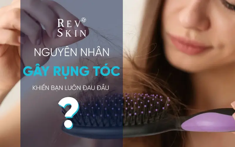 nguyen nhan rung toc