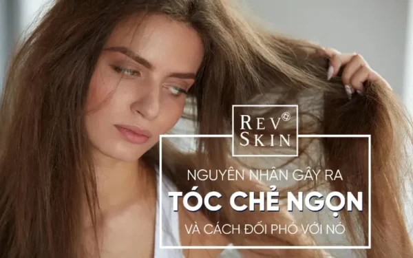 nguyen nhan toc che ngon