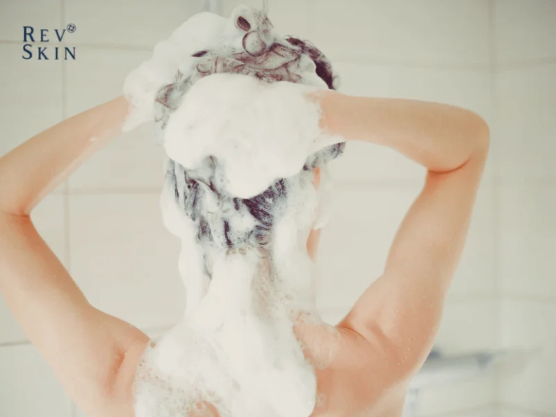 phuc hoi toc hu ton 3