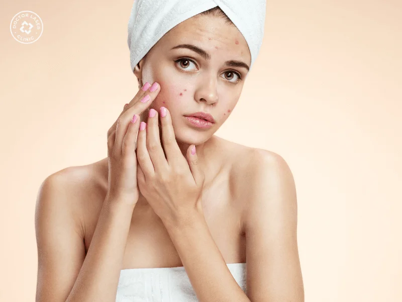 Uống bia có gây nổi mụn không 2