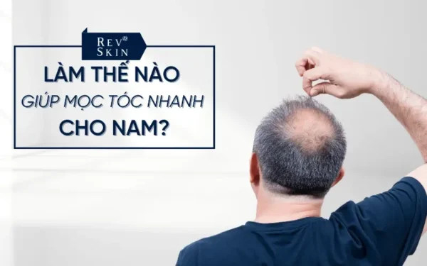 lam the nao giup moc toc nhanh cho nam