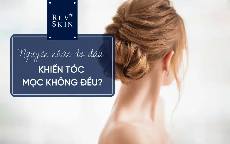 nguyen nhan do dau khien toc moc khong deu