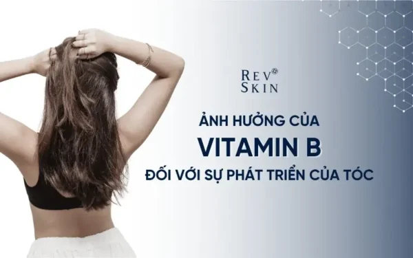 giai ma su anh huong cua vitamin b doi voi su phat trien cua toc