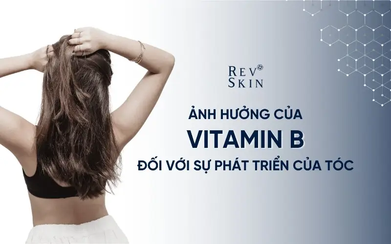 GIẢI MÃ SỰ ẢNH HƯỞNG CỦA VITAMIN B ĐỐI VỚI SỰ PHÁT TRIỂN CỦA TÓC giai ma su anh huong cua vitamin b doi voi su phat trien cua toc