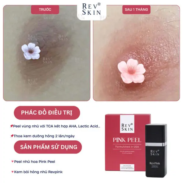 Alternative view of Kem Làm Hồng Giảm Thâm Vùng Nhũ Hoa Revskin Revpink Cream