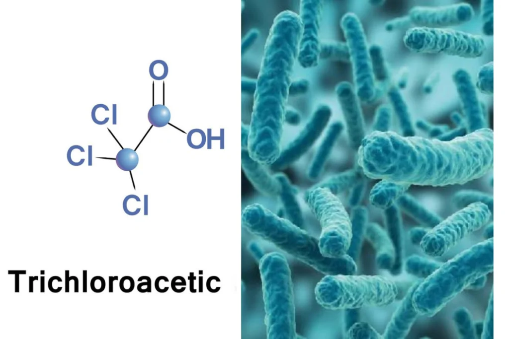 TCA và Lactic kết hợp là sự lựa chọn hoàn hảo trong peel da