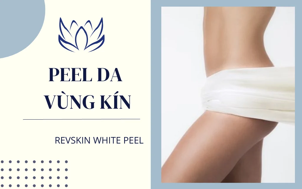 bia peel vung kin