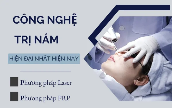 Công nghệ trị nám mới nhất