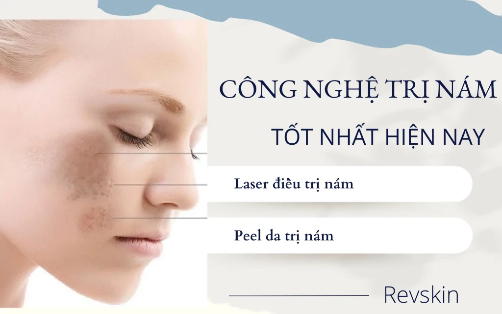 Công nghệ trị nám tàn nhang tốt nhất