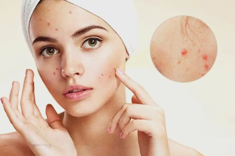 han che su dung my pham gay kich ung da