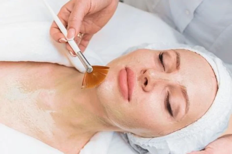 peel da co nguy hiem khong loi ich ma peel da mang lai la gi