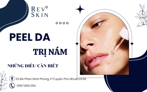 peel da tri nam va nhung dieu can biet