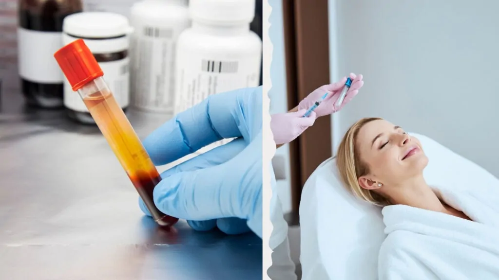 PRP đã trở thành một phương pháp làm đẹp an toàn và hiệu quả cho phái nữ