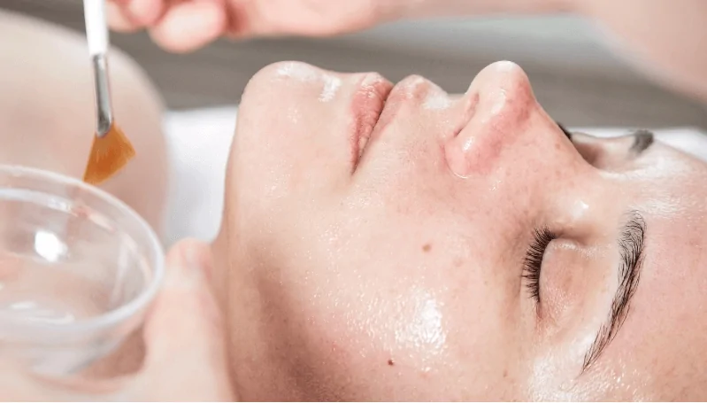 Peel da là hương pháp sử dụng các hoạt chất peel áp dụng lên bề mặt da