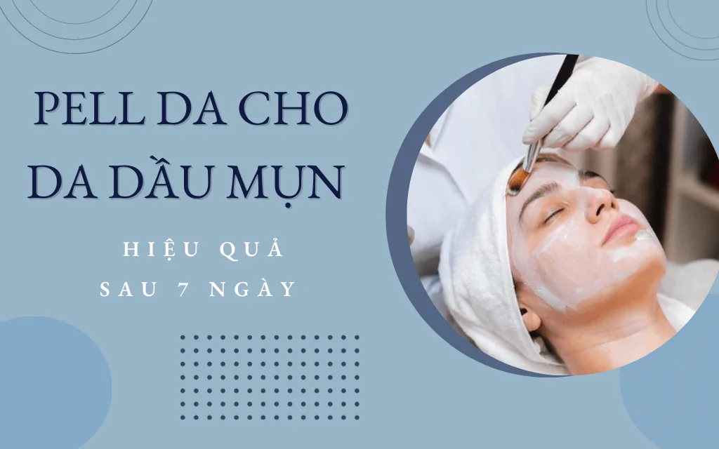 peel da cho da dầu mụn