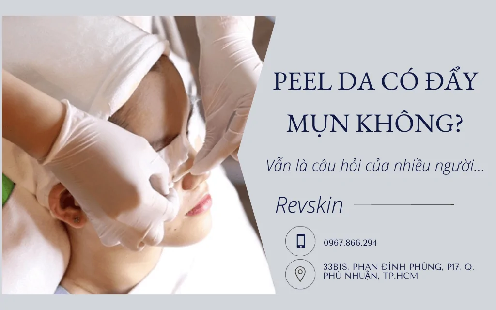 peel da có đẩy mụn không