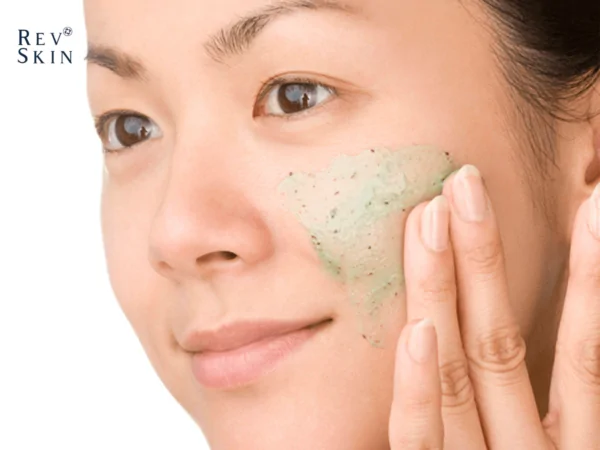 top 10 cach danh bay mun cam o cam nhanh gon 2