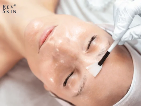 4 phuong phap tri mun an o tran nhanh chong 2