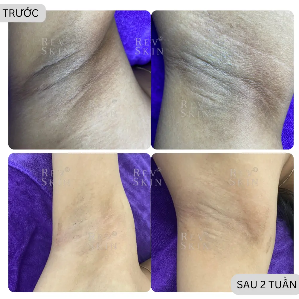 ban sao cua hinh feedback nach 1