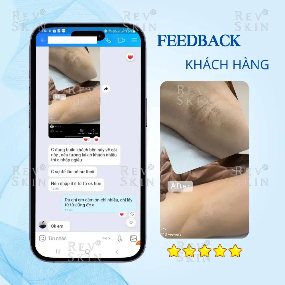 ban sao cua hinh feedback nach 3