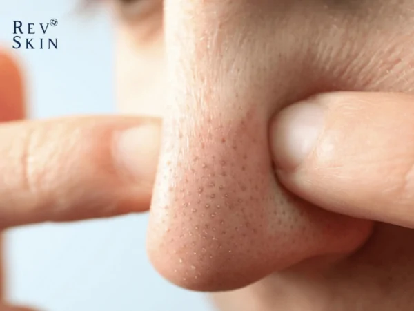 thiet ke chua co ten