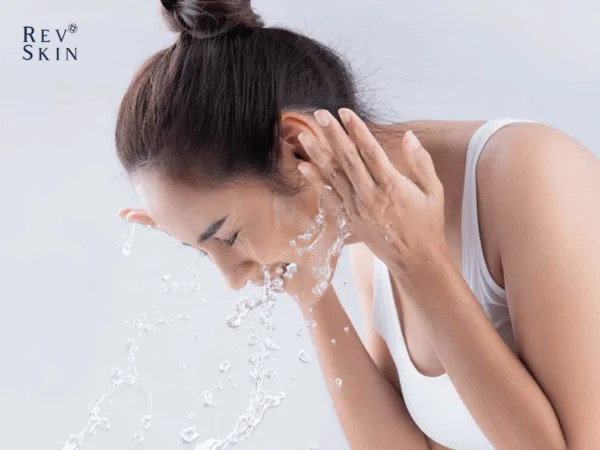 4 tips ngan ngua mun boc