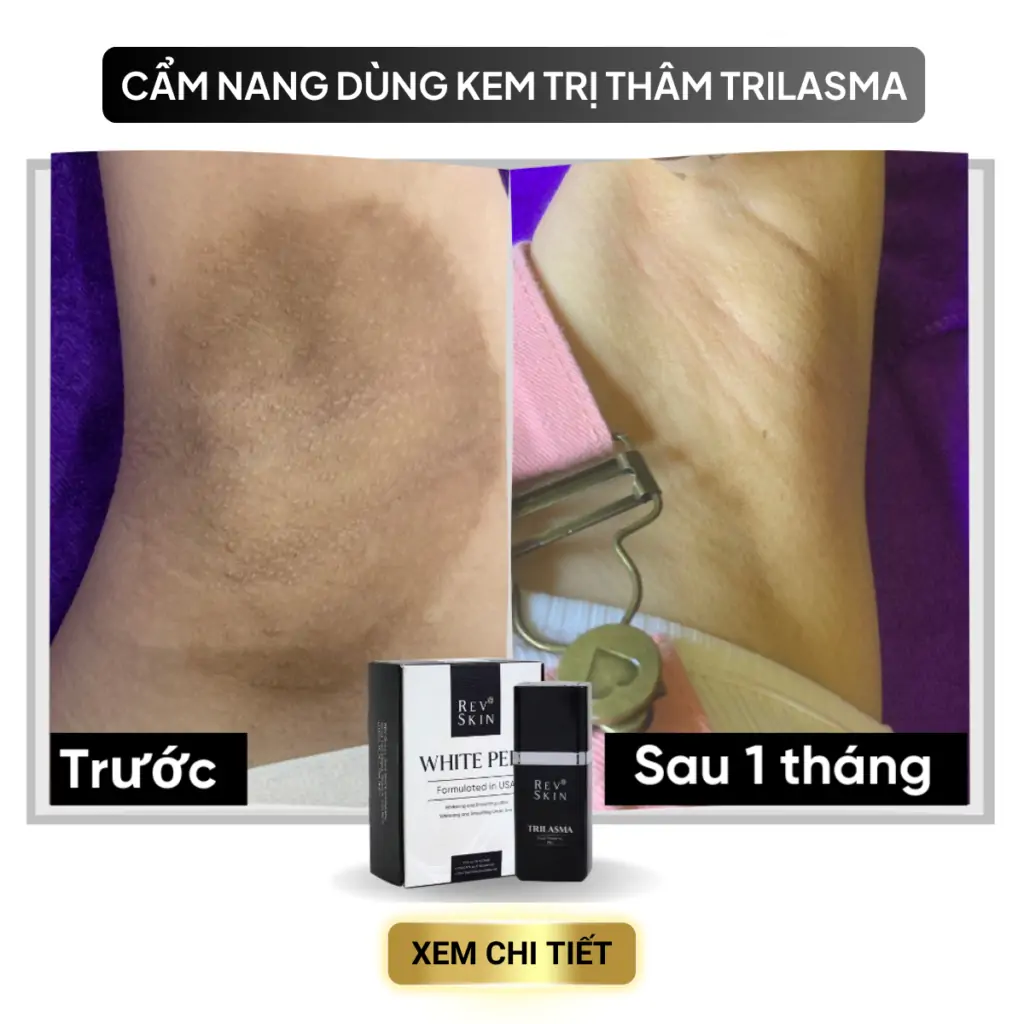 cac van de trong dieu tri mun 7 2