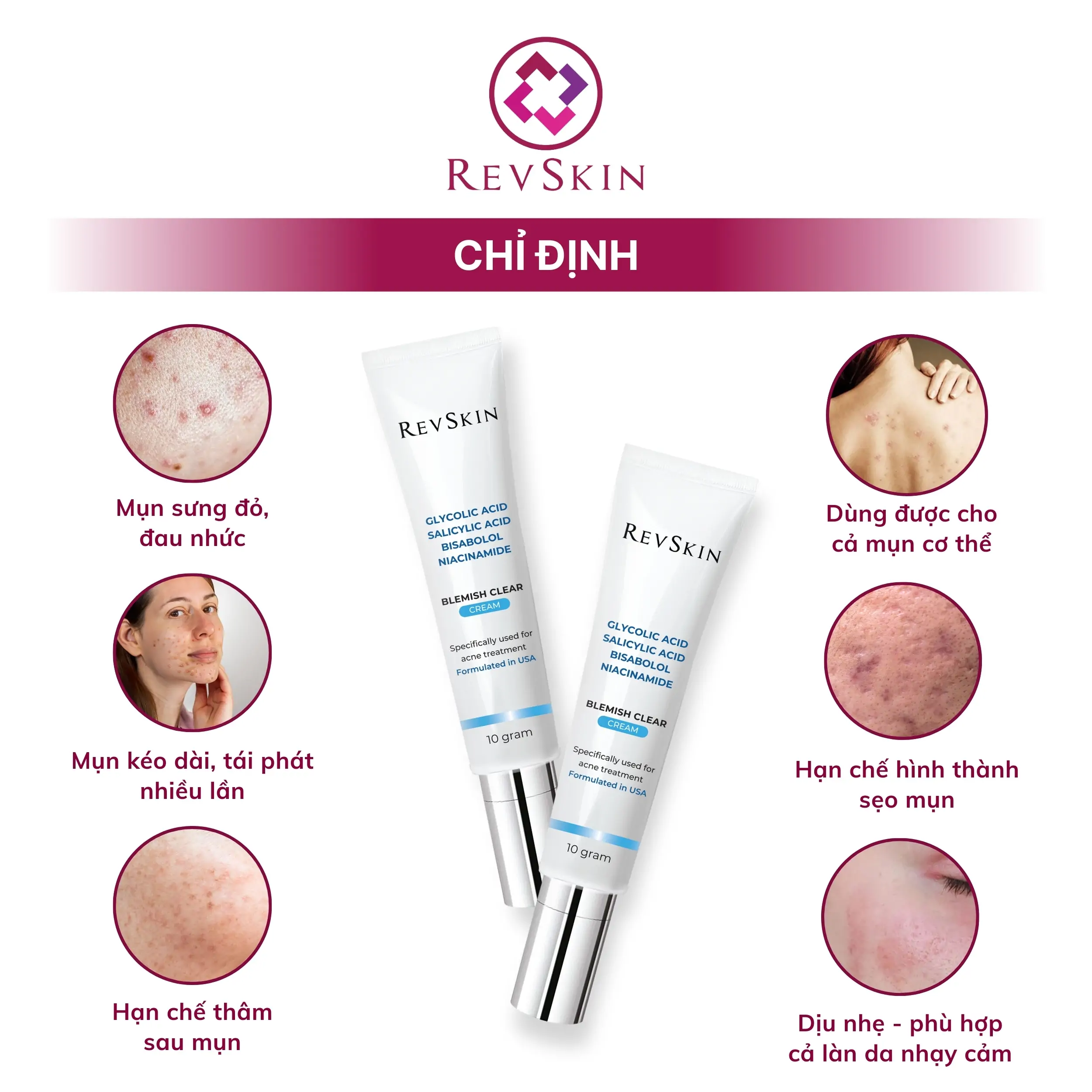 revskin blemish clear cream chi dinh