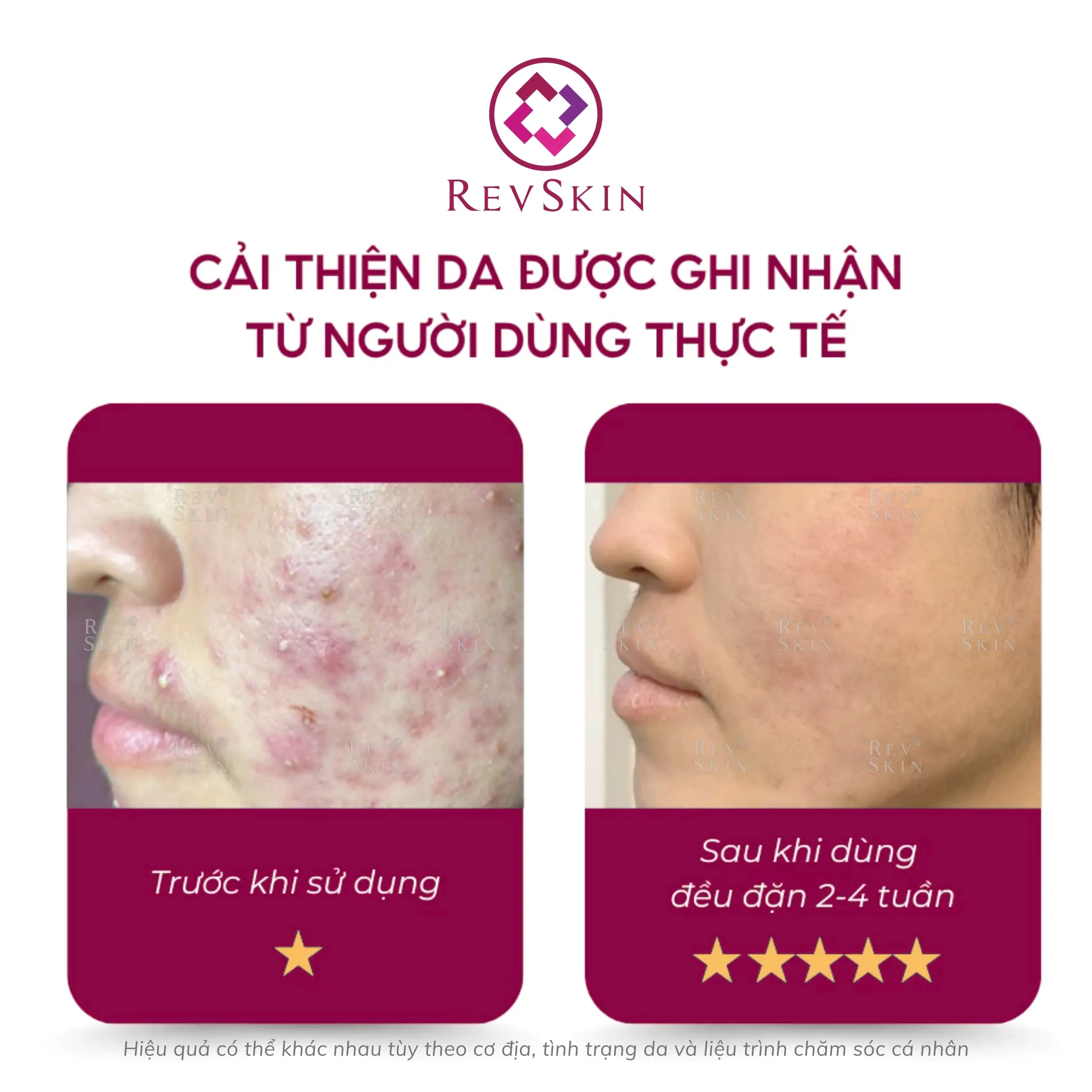 revskin blemish clear cream fb2