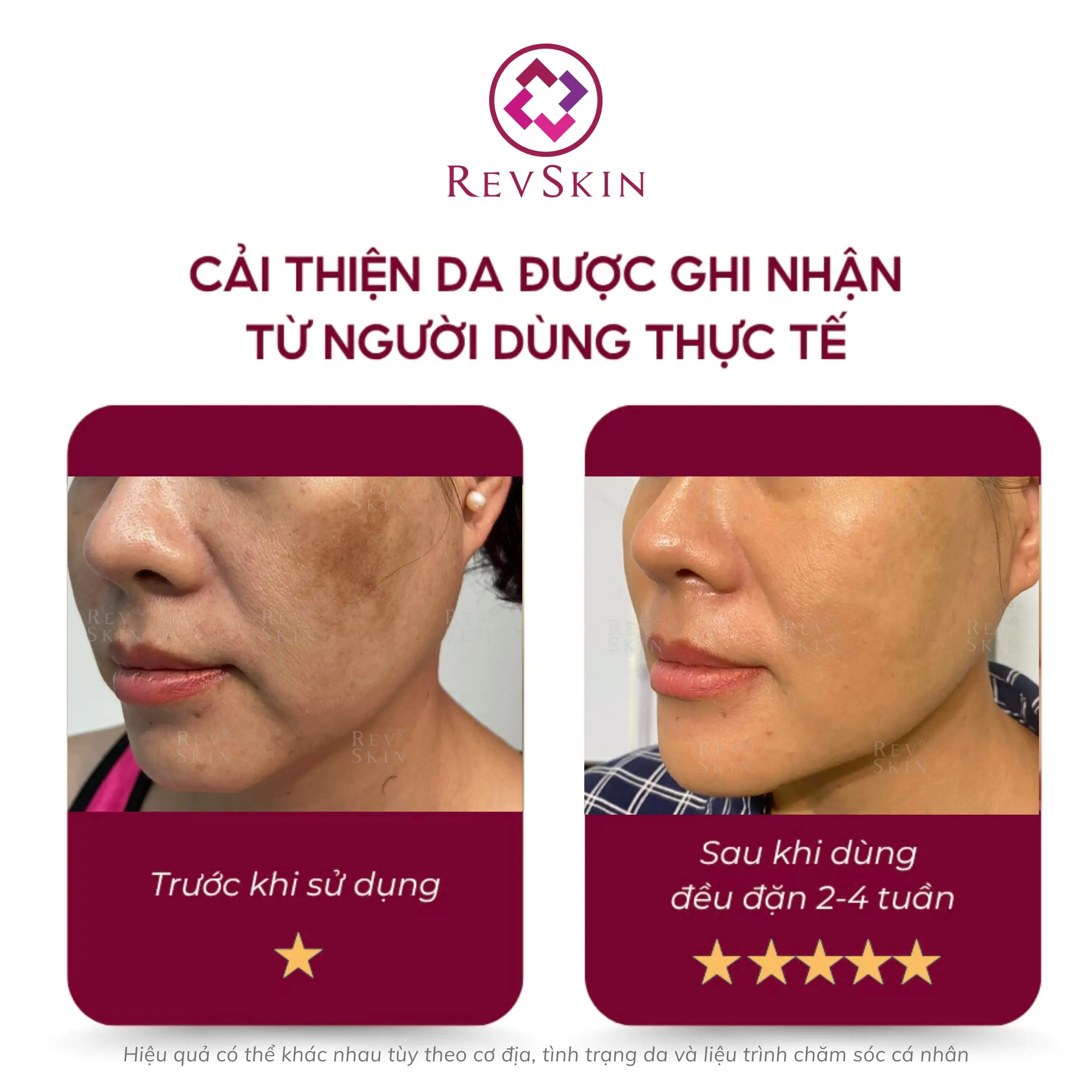 revskin cystamin cream fb1