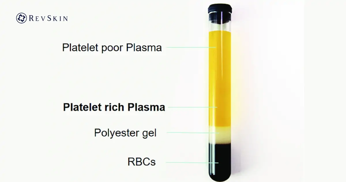 Bước ly tâm tách PRP