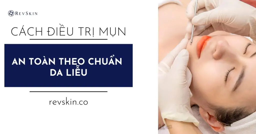 Cách điều trị mụn từng trừng hợp