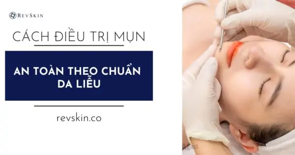 Cách điều trị mụn từng trừng hợp