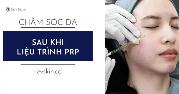 Chăm sóc da sau liệu trình PRP